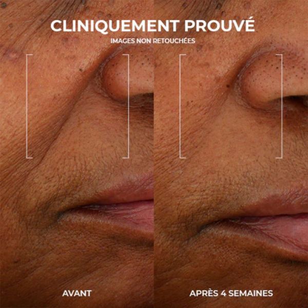 RoC Multi Correxion Renouveau + Éclat Crème Gel 50 ml – Gel-crème anti-âge et défatigant éclat