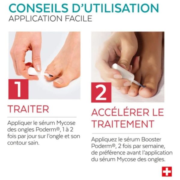 Poderm Duo Express Mycose des Ongles - traitement intensif anti-mycose avec booster