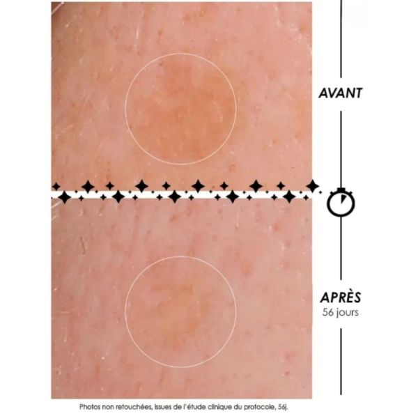 Garancia Eclair de Lune La Foudroyante Crème Anti-Taches 30ml + Stick solaire invisible sun protect SPF 50+