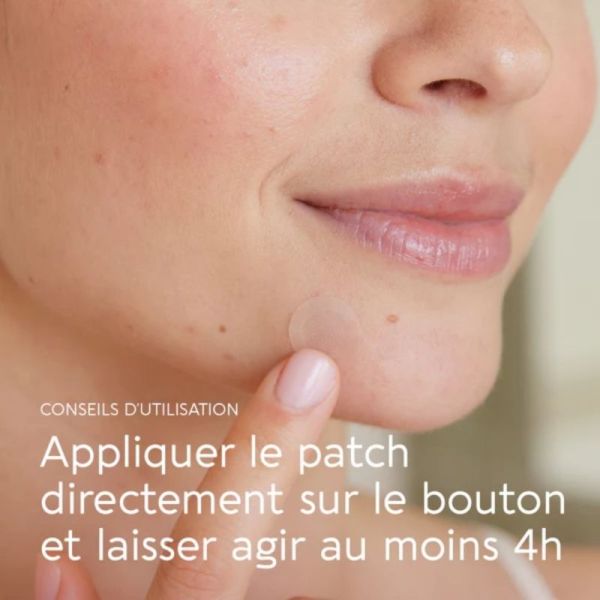 Biocyte Active Pimple Patchs X9 - Correcteur ciblé anti-imperfections et boutons aux actifs purifiants