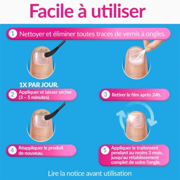 Cooper Excilor Forte Traitement de la Mycose de l'Ongle Antifongique - 30ml + Coupe Ongles