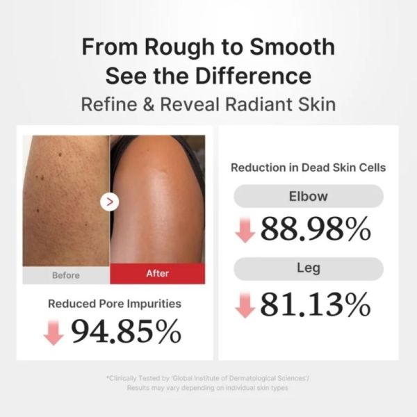 Medicube Hypochlorous Acid Body Peel Shot 280 ml - Soin exfoliant corporel purifiant