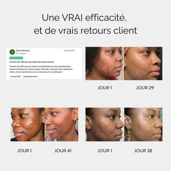 Curculia Pads Nettoyants Au Curcuma 3 En 1 30 Pads – Pureté et éclat