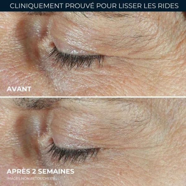 RoC Derm Correxion Contour Yeux Duo Lift 2x10 ml - Double effet lift du regard et action anti-rides